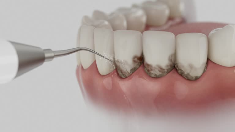 Trusted Root Canal Treatment service in Wahpeton, ND - Dentist Open Now